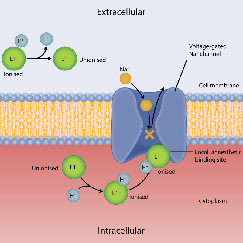 incompleteExcision-2D | Skintel Diagram of local anaesthetic mechanism of action