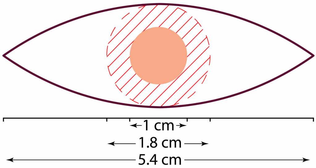 | Skintel Diagram of 4 mm surgical margins